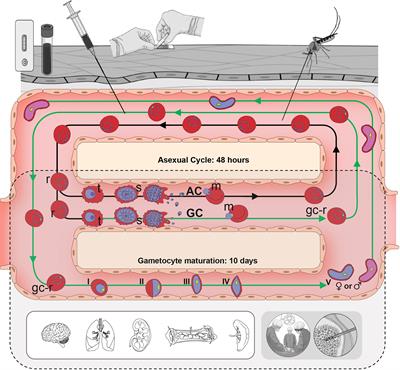 Stressed Out About Plasmodium falciparum Gametocytogenesis